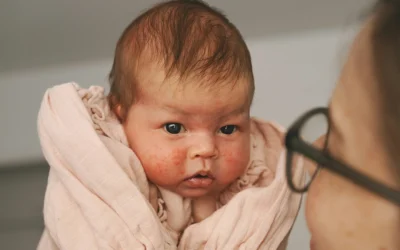 Bindehautentzündung bei Babys -Erkennen und Behandeln